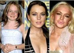 Nhìn lại quá trình &#8220;biến dạng&#8221; của Lindsay Lohan