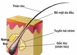 Điều trị tóc rụng