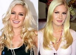 Heidi Montag gây sốc sau 10 ca thẩm mỹ - Paris Hilton tiệc tùng tới... rách cả váy!