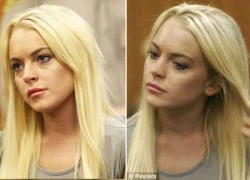 "Nghi vấn" Lindsay Lohan... bơm môi trước khi vào tù