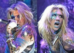 Ke$ha nổi bật với đôi môi... màu xanh