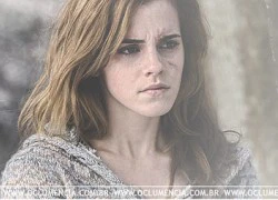 Gương mặt xinh đẹp của Emma Watson dính sẹo!