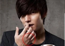 Ảnh bị thương "khó hiểu" của Lee Min Ho khiến fan lo lắng