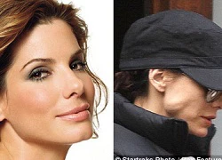 Mỹ nhân Hollywood Sandra Bullock lộ quai hàm lồi cộm bất thường