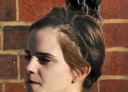 Emma Watson bất ngờ "lộ" da mặt sần sùi