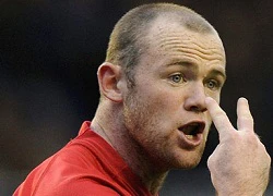 Rooney gặp họa vì những... chú khỉ