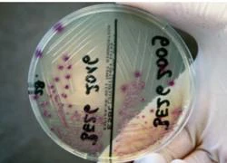 Dịch bệnh do khuẩn E.Coli ở châu Âu: Ca tử vong đầu tiên bên ngoài Đức, Berlin nói dưa chuột "vô can"