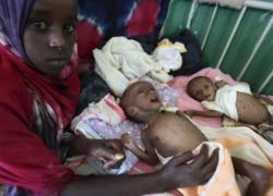 Hơn 29.000 trẻ em Somalia thiệt mạng vì nạn đói