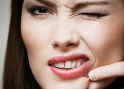 Công thức chuẩn để chăm sóc da mụn