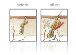 Giúp tóc ngưng rụng và mọc mới