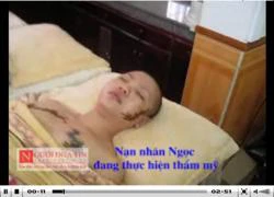 Video: Tâm sự của cô gái bị xăm rết vào mặt