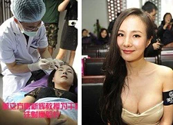 Can Lộ Lộ &#8220;lộ&#8221; ảnh tiêm botox trên bàn mổ