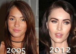 Megan Fox đang bị &#8220;nghiện&#8221; phẫu thuật thẩm mỹ?