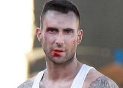 Adam Levine "bầm giập" trên trường quay MV mới