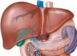 Các yếu tố làm tăng nguy cơ mắc ung thư gan