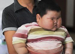 Bé 18 tháng tuổi nặng hơn 20 kg