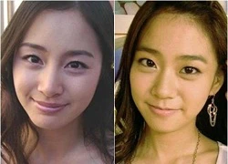 Thêm một bản sao của Kim Tae Hee