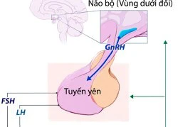 Chăm sóc buồng trứng - một vấn đề thiết yếu