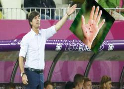 Chỉ tay Joachim Loew đấu hình xăm sao Italia