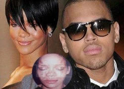 Rihanna sợ đau khổ khi yêu lại Chris Brown