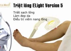 Cách phục hồi da mặt sau nghỉ hè?