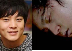 Joo Won kiệt sức và phải truyền nước