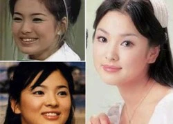 Lộ loạt ảnh thời mũm mĩm của Song Hye Kyo