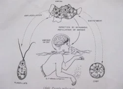 Một bệnh nhân tử vong vì 'amip ăn não người'