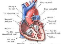 Các loại bệnh van tim