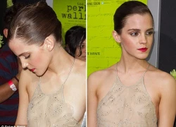 Emma Watson &#8216;lộ hàng&#8217; vì hớ hênh