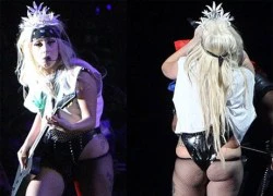 Tăng 13kg, Lady Gaga có thể đang mang thai