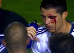 8 lần C. Ronaldo bị chơi xấu và đổ máu trên sân