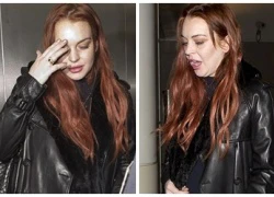 Lindsay Lohan gây sốc vì gương mặt sưng phù