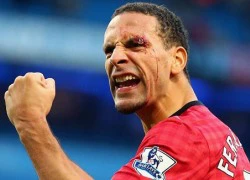 Rio Ferdinand đổ máu khi ăn mừng