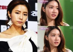 Shin Se Kyung lại dính nghi án phẫu thuật thẩm mỹ