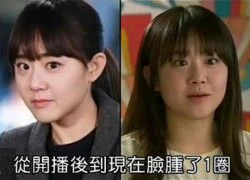 Moon Geun Young bị nghi bơm botox khiến mặt cứng đơ