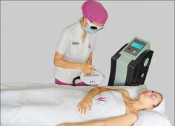 Triệt lông IPL an toàn hiệu quả