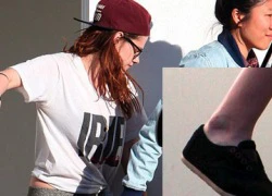 Cận cảnh bàn chân bị thương của Kristen Stewart