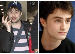 "Harry Porter" Daniel Radcliffe xuống sắc trầm trọng