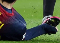 Messi bị giẫm 'nát' ngón tay