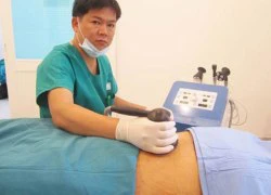 Hút mỡ bụng không lồi lõm bằng Lipo - RF