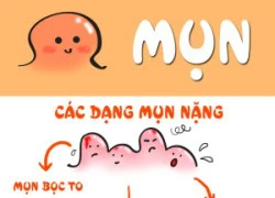 Mổ xẻ các dạng mụn nặng và cách điều trị