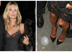 Siêu mẫu Kate Moss lộ đầu gối dị dạng