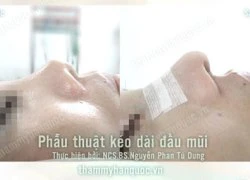 Tutoplast - kỹ thuật chỉnh hình mũi ngắn