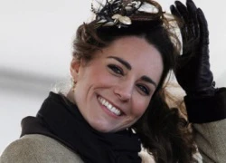 Xu hướng thẩm mỹ mũi giống Kate Middleton