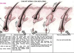 Kiến thức về triệt lông bạn nên biết