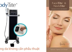 Trẻ hóa da với công nghệ BodyTite