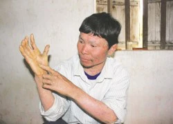 Gia tộc "giời đày"