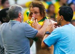 David Luiz phải đeo mặt nạ