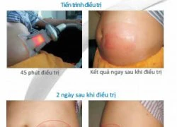 Giảm béo nhanh hiệu quả trong 1 tuần